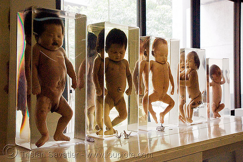 ศพเด็ก - dead babies, preserved - forensic medecine museum, โรงพยาบาลศิริราช - siriraj hospital, bangkok (thailand)