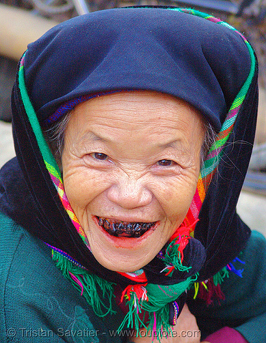 tribe woman with black teeth (a cultural and traditional sign of beauty), and bloody lips (caused by chewing betelnut) - vietnam