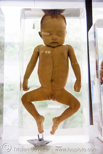 dead baby preserved - forensic medicine museum - siriraj hospital - bangkok (thailand), bangkok, cadaver, corpse, dead baby, death, forensic medicine museum, human remains, jar, siriraj hospital, specimen, บางกอก, โรงพยาบาลศิริราช