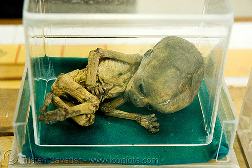 dead fetus, mummified - ศพเด็ก - forensic medicine museum, โรงพยาบาลศิริราช - siriraj hospital, bangkok (thailand), bangkok, cadaver, corpse, dead baby, dead fetus, death, forensic medicine museum, human remains, siriraj hospital, บางกอก, ศพเด็ก, โรงพยาบาลศิริราช