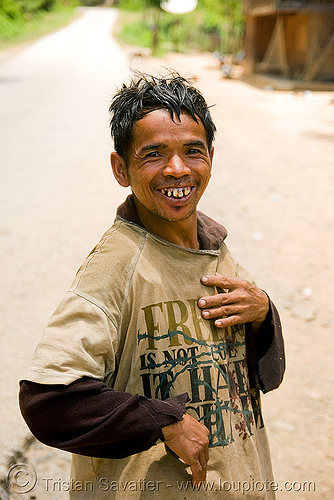 guy with bad teeth in village (laos), bad teeth, decayed teeth, guy, man