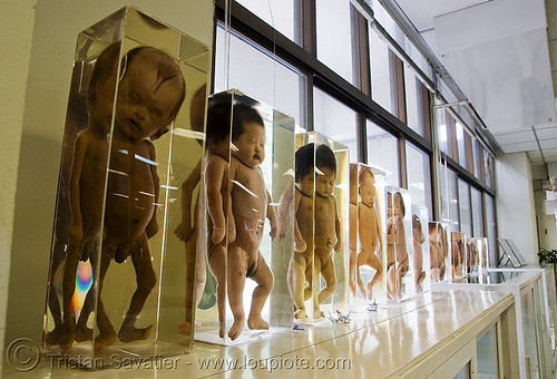 ศพเด็ก - bodies of dead babies, preserved - forensic medicine museum, โรงพยาบาลศิริราช - siriraj hospital, bangkok (thailand), backlight, bangkok, cadavers, corpses, dead babies, death, jars, siriraj hospital, บางกอก, ศพ, โรงพยาบาลศิริราช