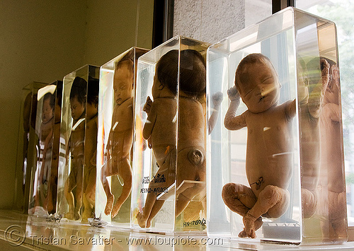 ศพเด็ก - dead babies, preserved - forensic medicine museum, โรงพยาบาลศิริราช - siriraj hospital, bangkok (thailand), backlight, bangkok, cadavers, corpses, dead babies, death, jar, siriraj hospital, บางกอก, ศพ, โรงพยาบาลศิริราช