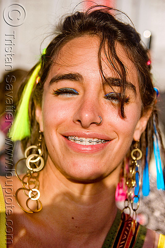 girl smiling with dental braces, daniela reul, dental braces, earrings, lovevolution, orthodontic braces, teeth, woman