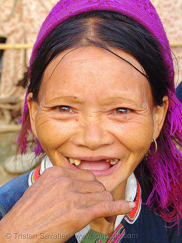 "kim mun lantien sha" dao/yao tribe woman missing a few teeth - vietnam, asian woman, bảo lạc, dao, dzao tribe, hill tribes, indigenous, kim mun lantien sha, old, teeth, yao tribe