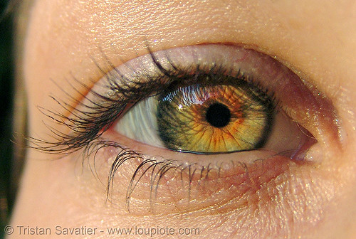 eye iris freckles
