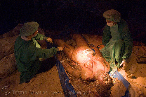 tsunami victim's decomposed body - corpse - cadaver, cadaver, corpse, dead, decomposed body, decomposing, emergency services, forensic medicine museum, human remains, medics, paramedics, putrefied, siriraj hospital, tsunami victim, เหยื่อ คลื่นยักษ์สึนามิ, โรงพยาบาลศิริราช