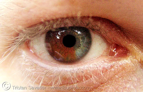 eye with heterochromia - iris closeup, beautiful eyes, bicolor, brown and grey, closeup, eye color, eyelashes, ilya, iris, man, sectoral heterochromia, two colors